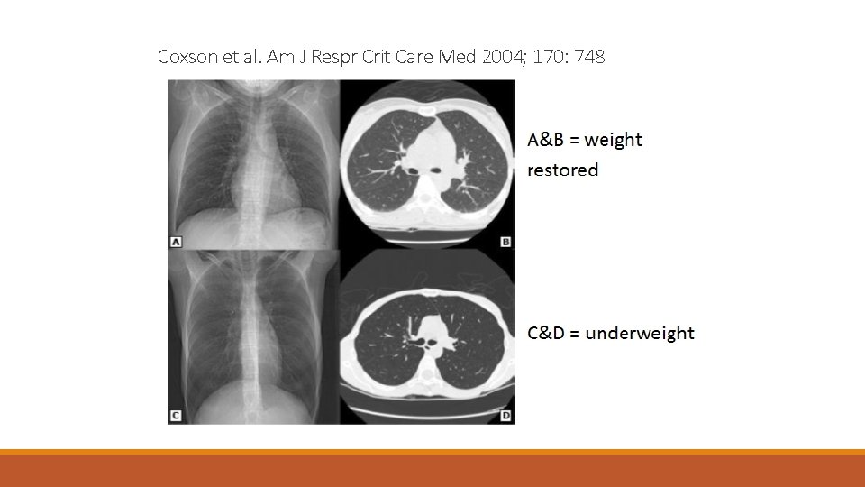 Coxson et al. Am J Respr Crit Care Med 2004; 170: 748 