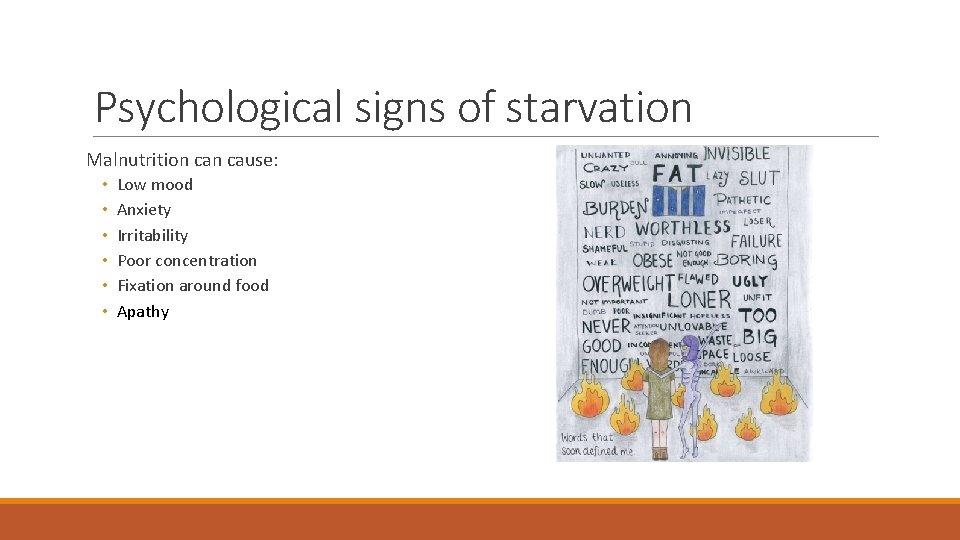 Psychological signs of starvation Malnutrition cause: • • • Low mood Anxiety Irritability Poor