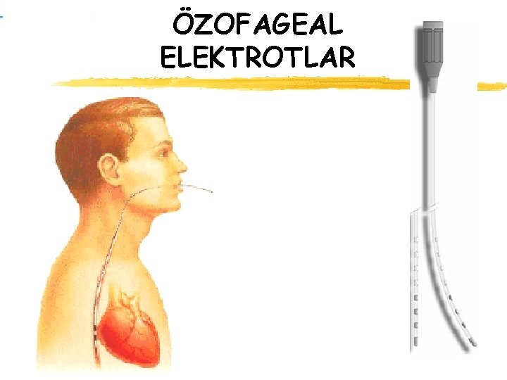 ÖZOFAGEAL ELEKTROTLAR 