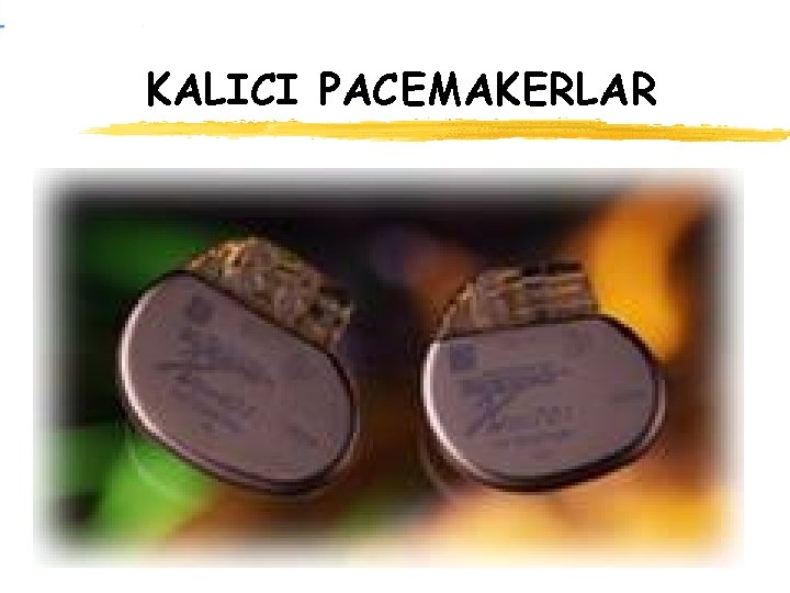 KALICI PACEMAKERLAR 