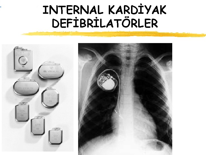 INTERNAL KARDİYAK DEFİBRİLATÖRLER 