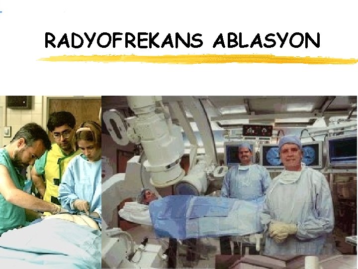 RADYOFREKANS ABLASYON 