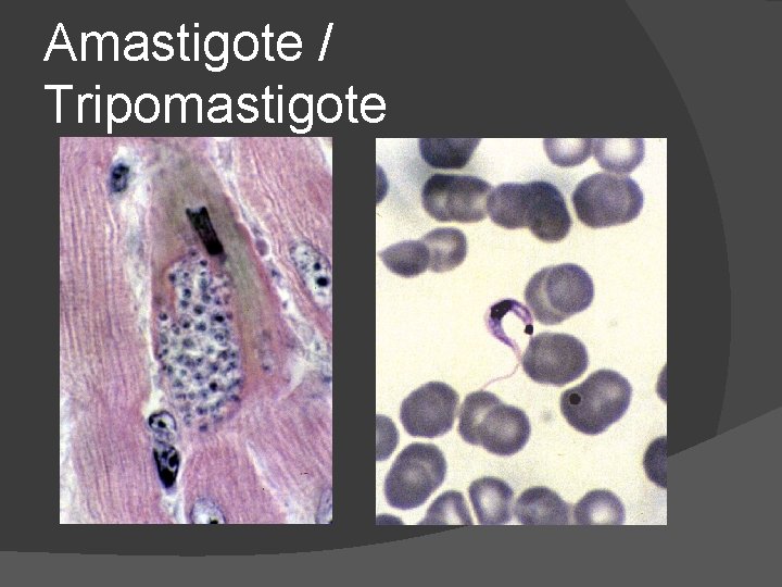 Amastigote / Tripomastigote 