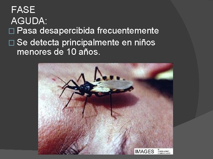 FASE AGUDA: � Pasa desapercibida frecuentemente � Se detecta principalmente en niños menores de