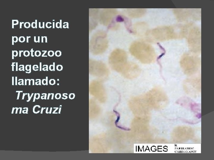 Producida por un protozoo flagelado llamado: Trypanoso ma Cruzi 