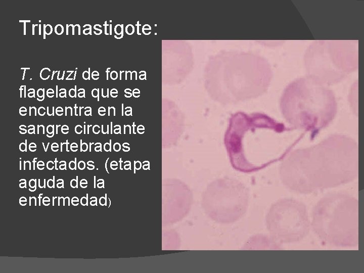 Tripomastigote: T. Cruzi de forma flagelada que se encuentra en la sangre circulante de