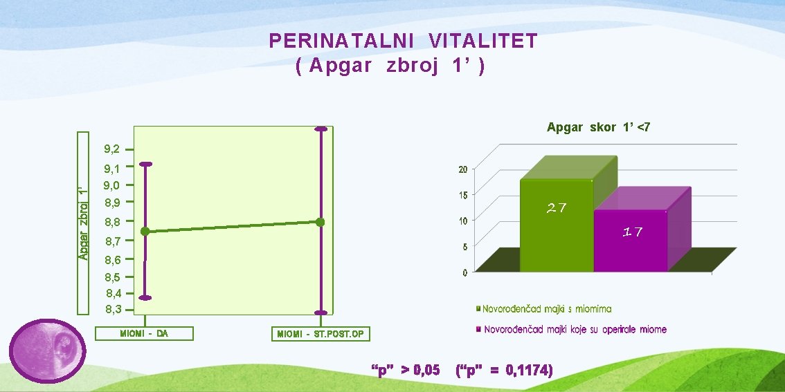 PERINATALNI VITALITET ( Apgar zbroj 1’ ) Apgar skor 1’ <7 9, 2 Apgar