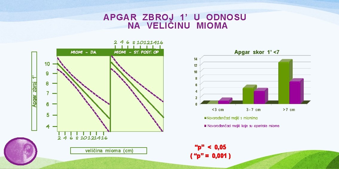 APGAR ZBROJ 1’ U ODNOSU NA VELIČINU MIOMA 2 4 6 8 10121416 MIOMI