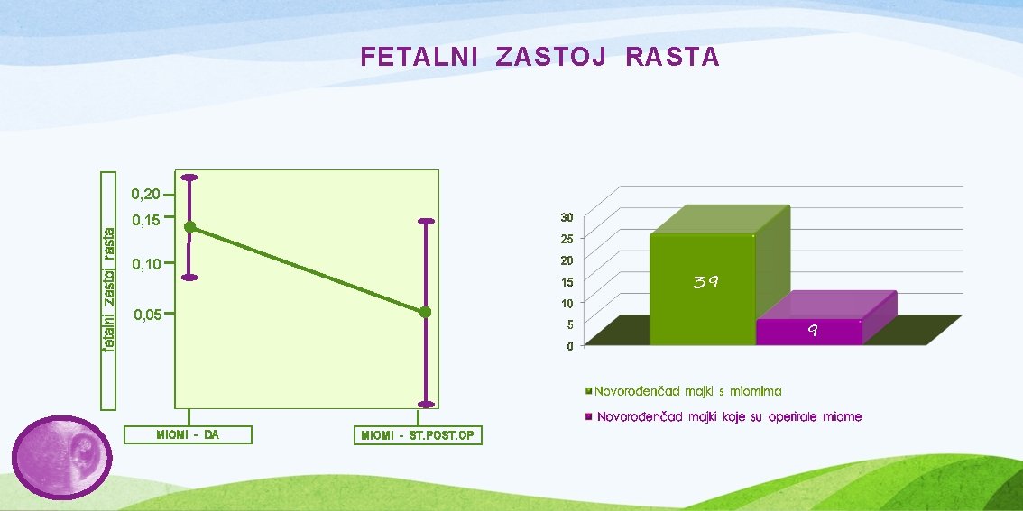 FETALNI ZASTOJ RASTA fetalni zastoj rasta 0, 20 0, 15 5 39 0, 10