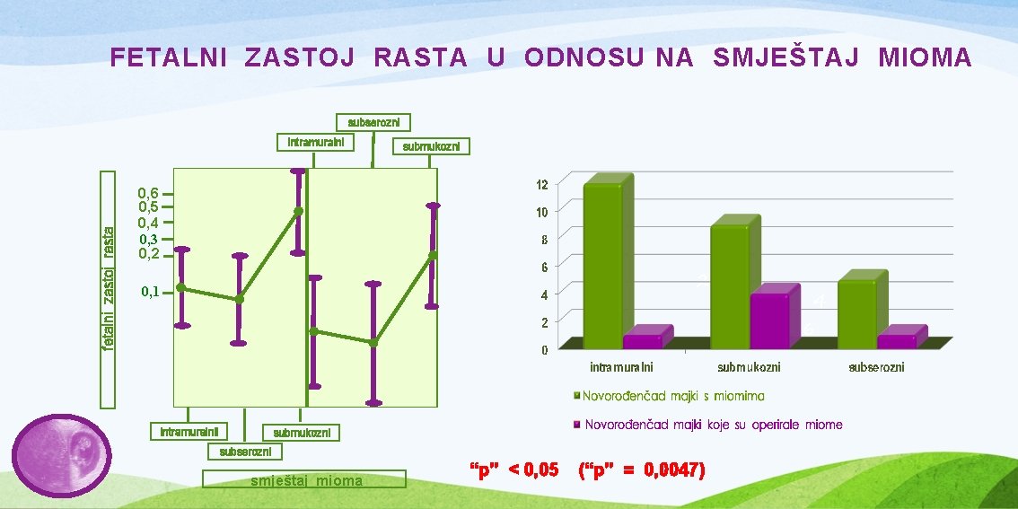 FETALNI ZASTOJ RASTA U ODNOSU NA SMJEŠTAJ MIOMA subserozni fetalni zastoj rasta intramuralni submukozni