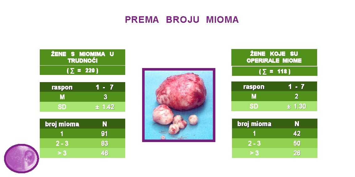 PREMA BROJU MIOMA ŽENE S MIOMIMA U TRUDNOĆI ŽENE KOJE SU OPERIRALE MIOME (