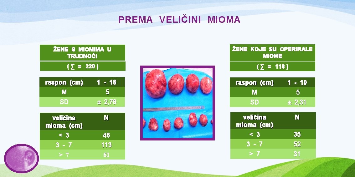 PREMA VELIČINI MIOMA ŽENE S MIOMIMA U TRUDNOĆI ŽENE KOJE SU OPERIRALE MIOME (