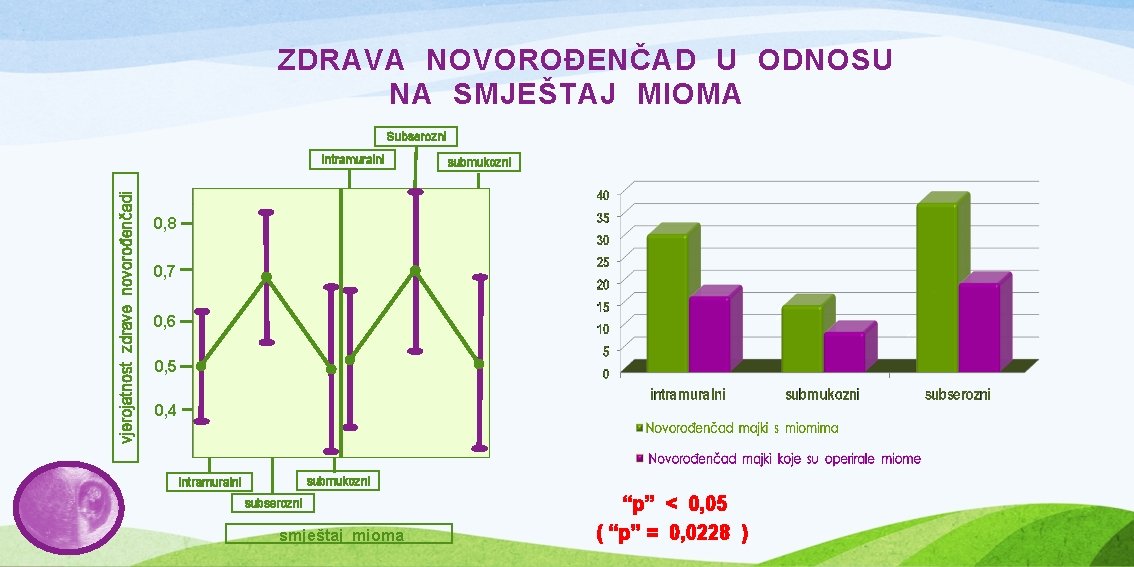 ZDRAVA NOVOROĐENČAD U ODNOSU NA SMJEŠTAJ MIOMA Subserozni vjerojatnost zdrave novorođenčadi intramuralni submukozni 0,