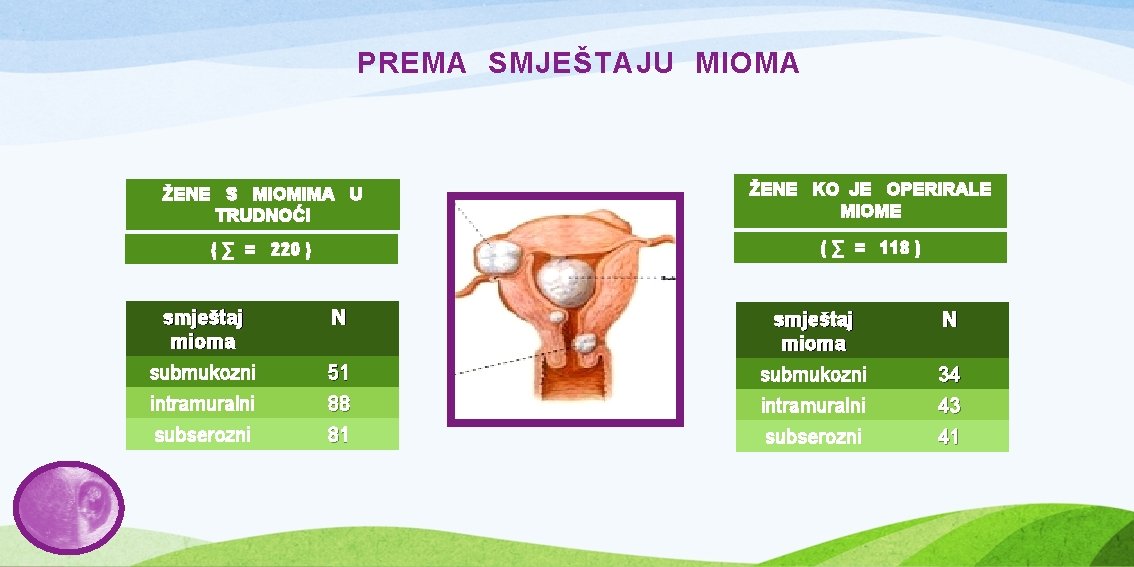 PREMA SMJEŠTAJU MIOMA ŽENE S MIOMIMA U TRUDNOĆI ŽENE KO JE OPERIRALE MIOME (