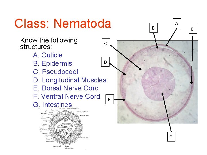 Class: Nematoda A B Know the following C structures: A. Cuticle D B. Epidermis