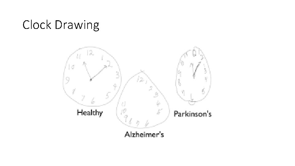 Clock Drawing 