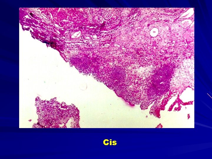 Cis 