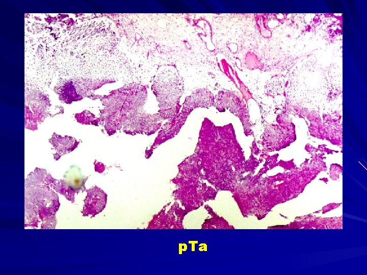p. Ta 