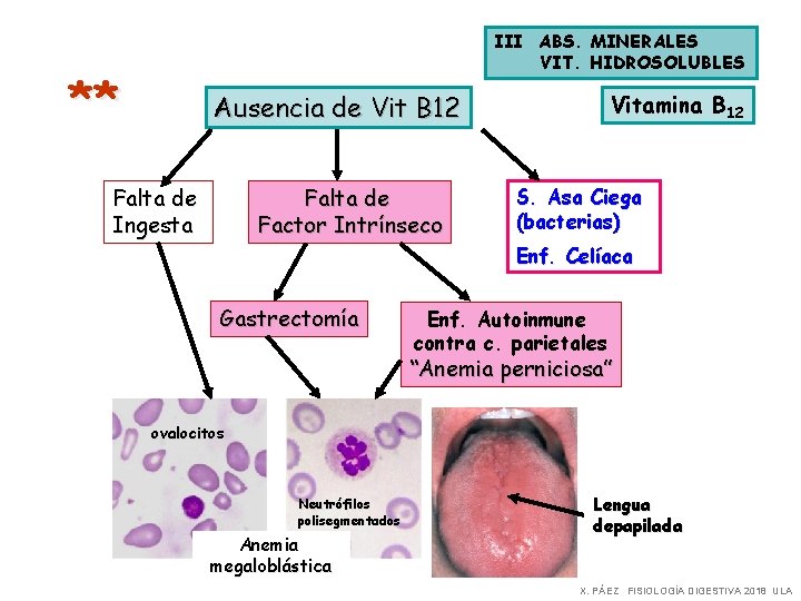 III ABS. MINERALES VIT. HIDROSOLUBLES ** Ausencia de Vit B 12 Falta de Ingesta