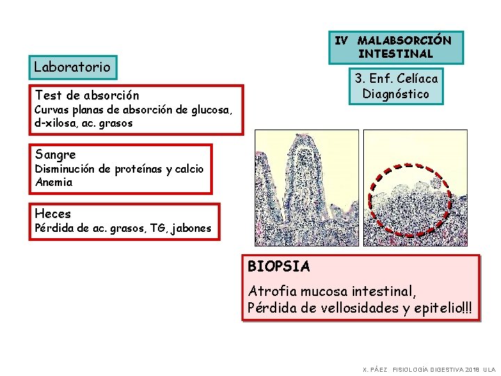 IV MALABSORCIÓN INTESTINAL Laboratorio 3. Enf. Celíaca Diagnóstico Test de absorción Curvas planas de