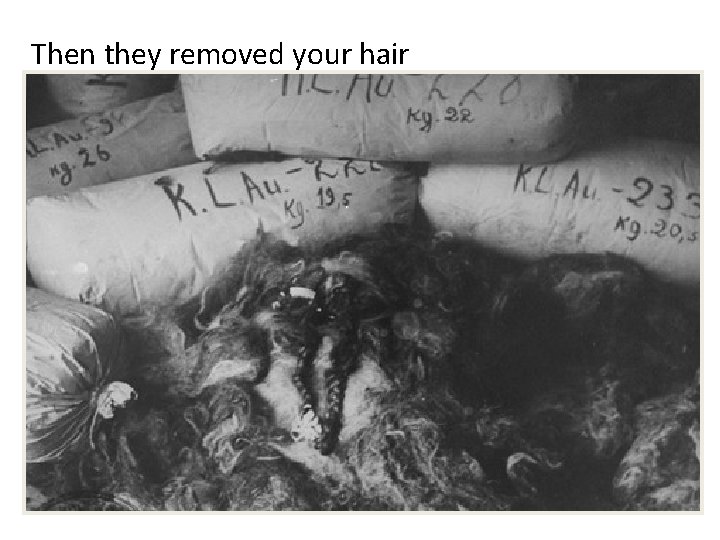 Then they removed your hair Then they removed your hair