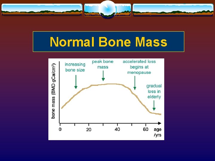 Normal Bone Mass 