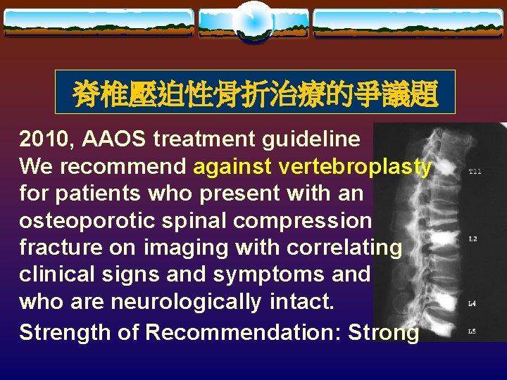脊椎壓迫性骨折治療的爭議題 2010, AAOS treatment guideline We recommend against vertebroplasty for patients who present with