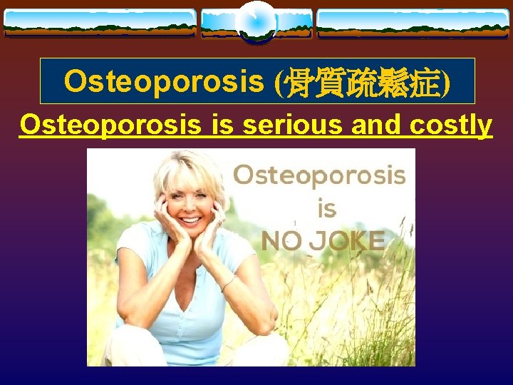 Osteoporosis (骨質疏鬆症) Osteoporosis is serious and costly 
