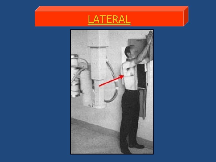 LATERAL 