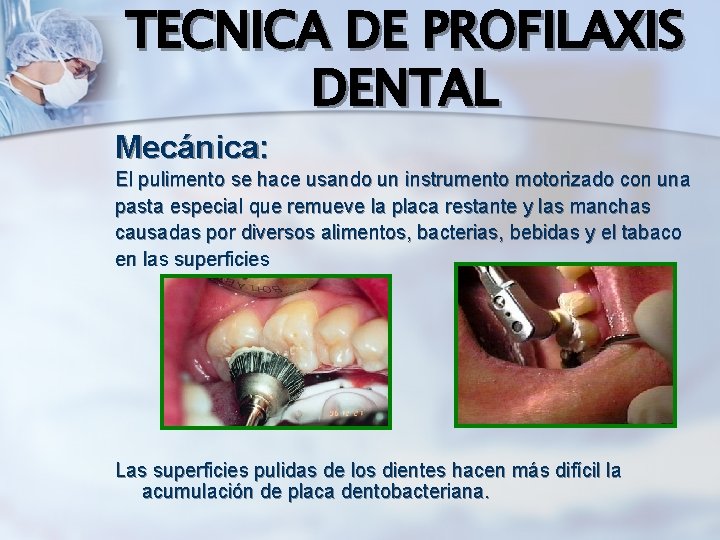 TECNICA DE PROFILAXIS DENTAL Mecánica: El pulimento se hace usando un instrumento motorizado con