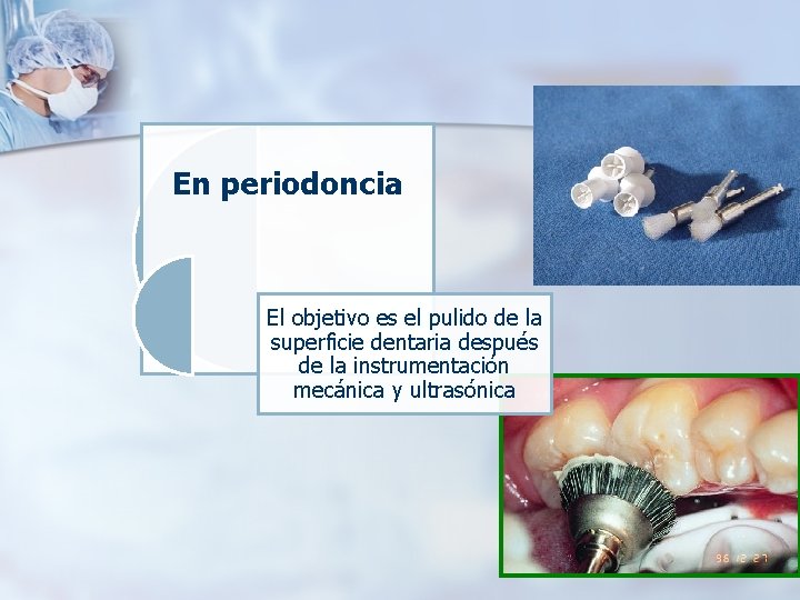  En periodoncia El objetivo es el pulido de la superficie dentaria después de