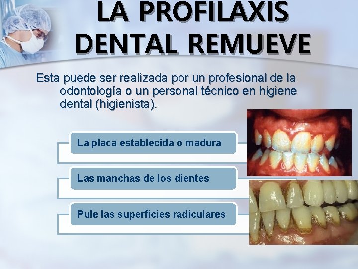 LA PROFILAXIS DENTAL REMUEVE Esta puede ser realizada por un profesional de la odontología