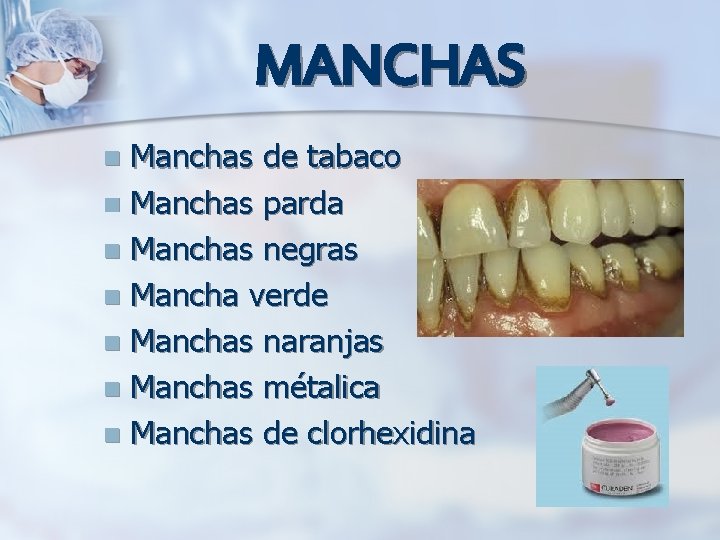 MANCHAS Manchas de tabaco n Manchas parda n Manchas negras n Mancha verde n