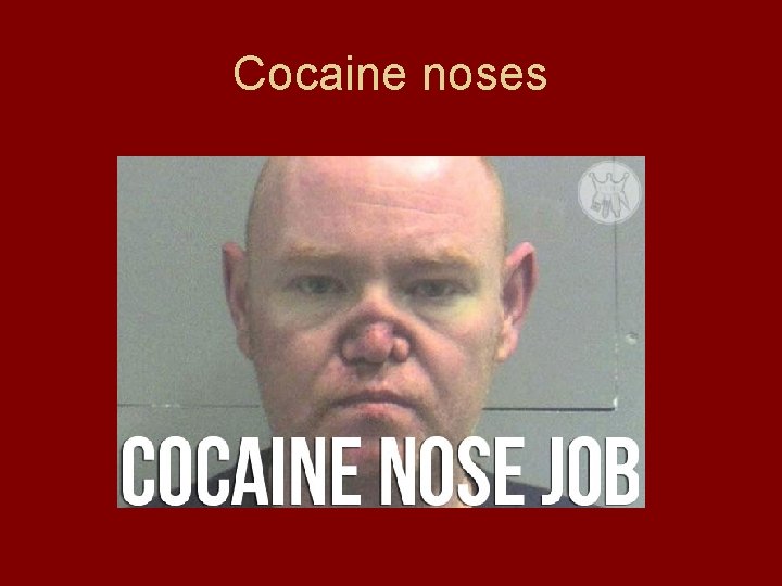 Cocaine noses 