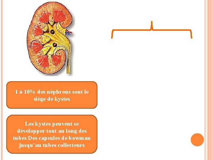 1 à 10% des néphrons sont le siège de kystes Les kystes peuvent se