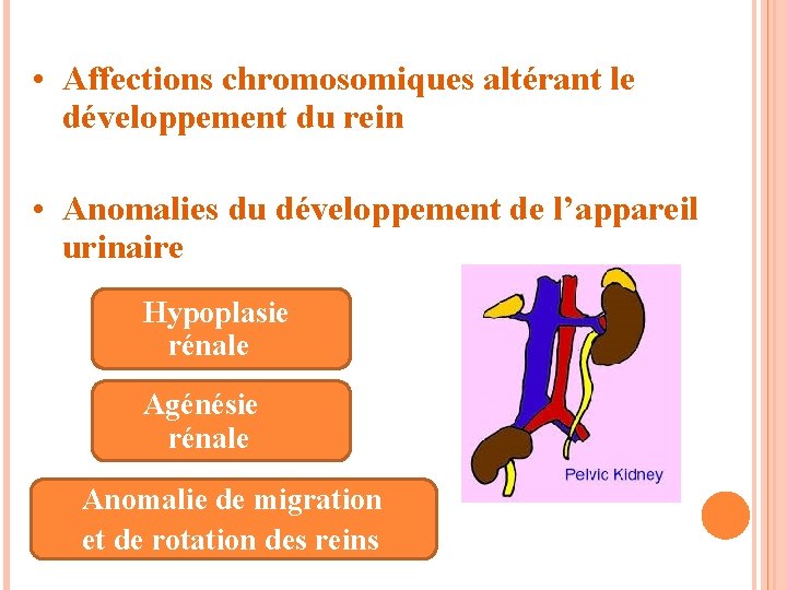  • Affections chromosomiques altérant le développement du rein • Anomalies du développement de