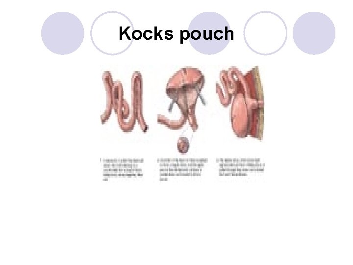 Kocks pouch Kocks pouch
