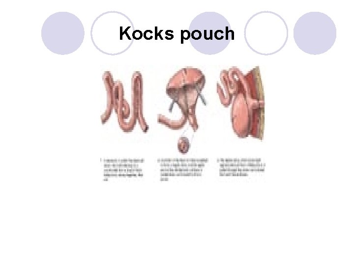 Kocks pouch 