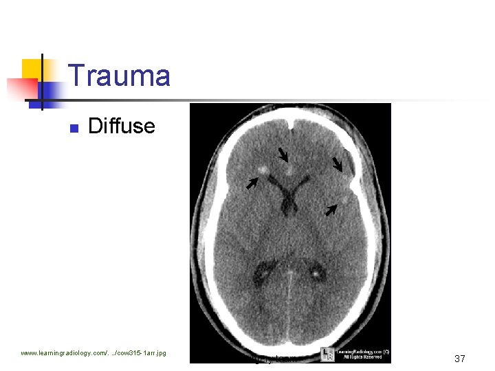 Trauma n Diffuse www. learningradiology. com/. . . /cow 315 -1 arr. jpg 428