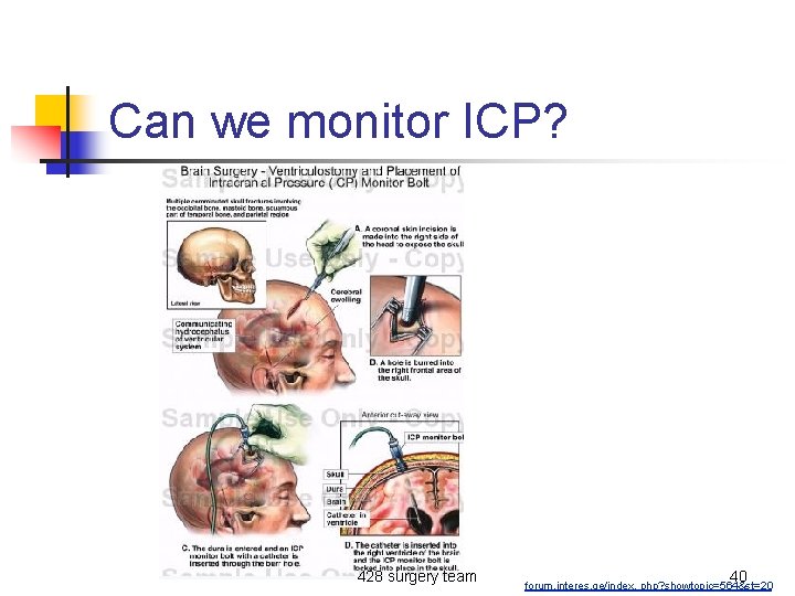 Can we monitor ICP? 428 surgery team 40 forum. interes. ge/index. php? showtopic=564&st=20 