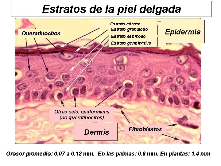 Estratos de la piel delgada Estrato córneo Estrato granuloso Queratinocitos Estrato espinoso Epidermis Estrato
