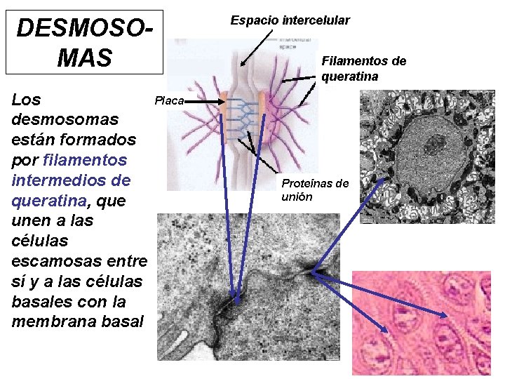 DESMOSOMAS Placa Los desmosomas están formados por filamentos intermedios de queratina, que unen a