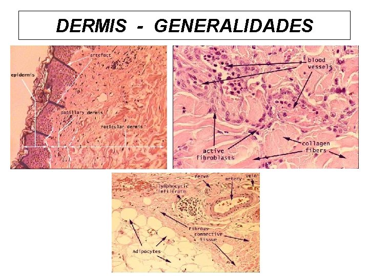 DERMIS - GENERALIDADES 