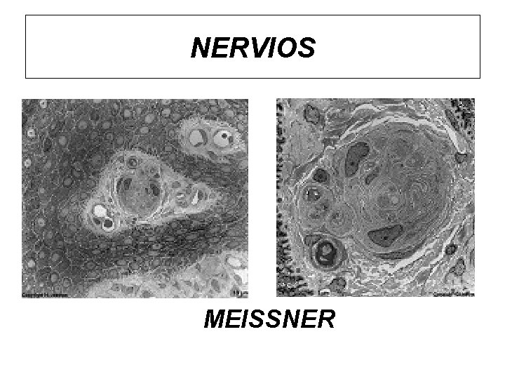 NERVIOS MEISSNER 