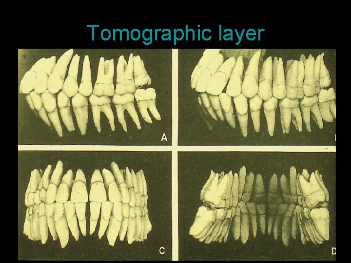 Tomographic layer 