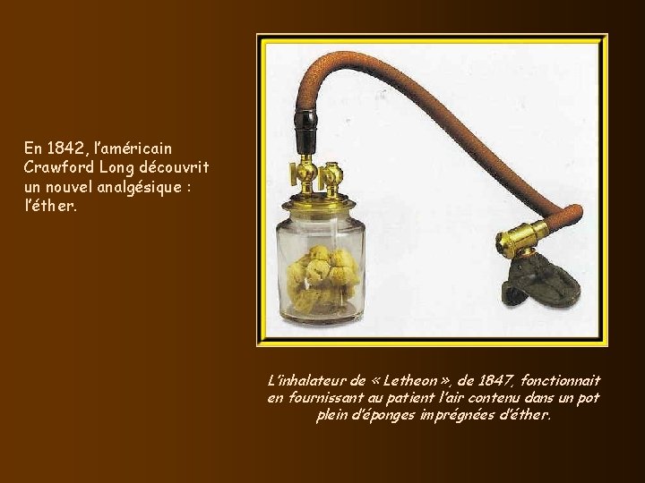 En 1842, l’américain Crawford Long découvrit un nouvel analgésique : l’éther. L’inhalateur de «