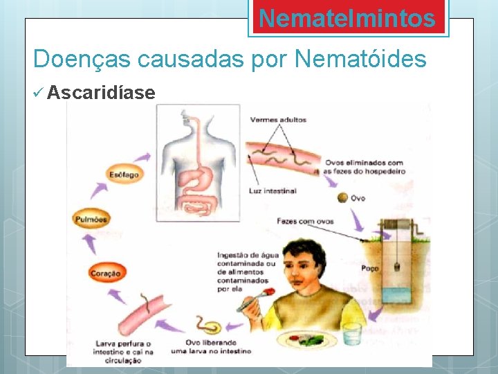 Nematelmintos Doenças causadas por Nematóides ü Ascaridíase 