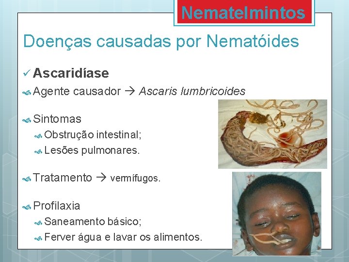 Nematelmintos Doenças causadas por Nematóides ü Ascaridíase Agente causador Ascaris lumbricoides Sintomas Obstrução intestinal;