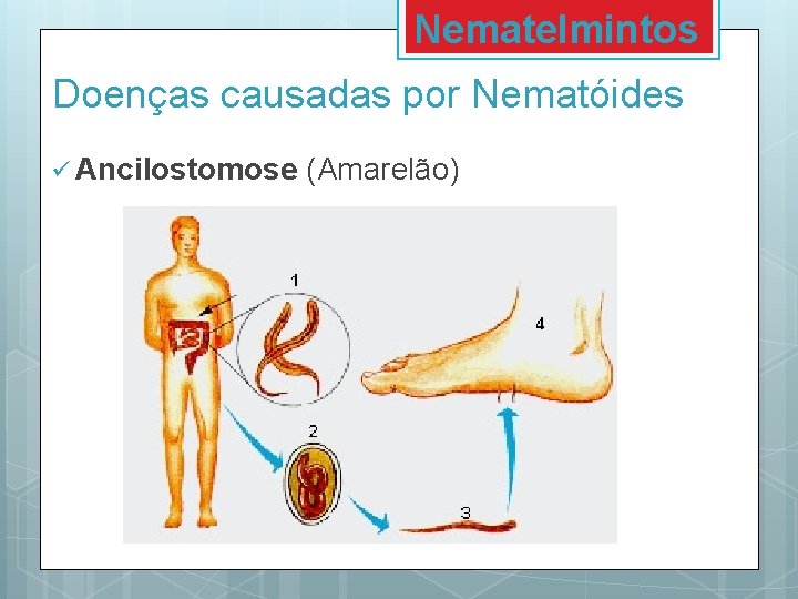 Nematelmintos Doenças causadas por Nematóides ü Ancilostomose (Amarelão) 