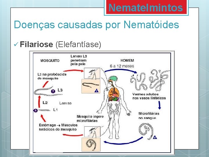 Nematelmintos Doenças causadas por Nematóides ü Filariose (Elefantíase) 